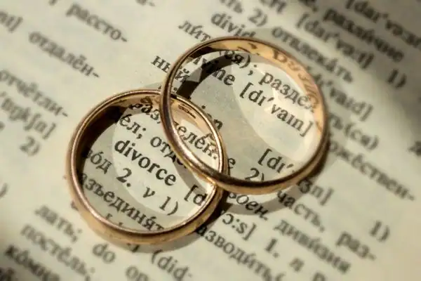 Image of rings removed before divorce mediation Rayleigh